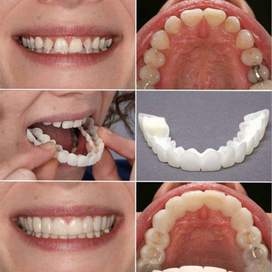 Silicone Imitation Braces Teeth Decoration Kit – Safe & Reusable Snap-On Smile Cover for Stylish Cosmetic Look