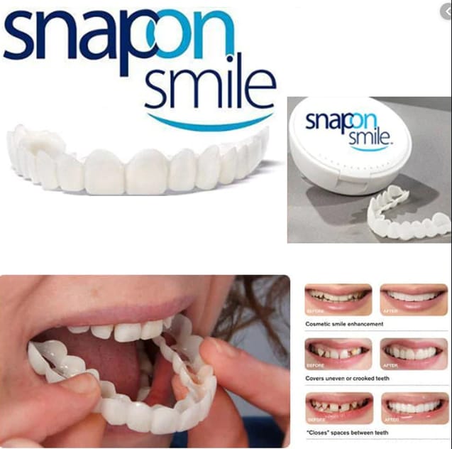 Silicone Imitation Braces Teeth Decoration Kit – Safe & Reusable Snap-On Smile Cover for Stylish Cosmetic Look